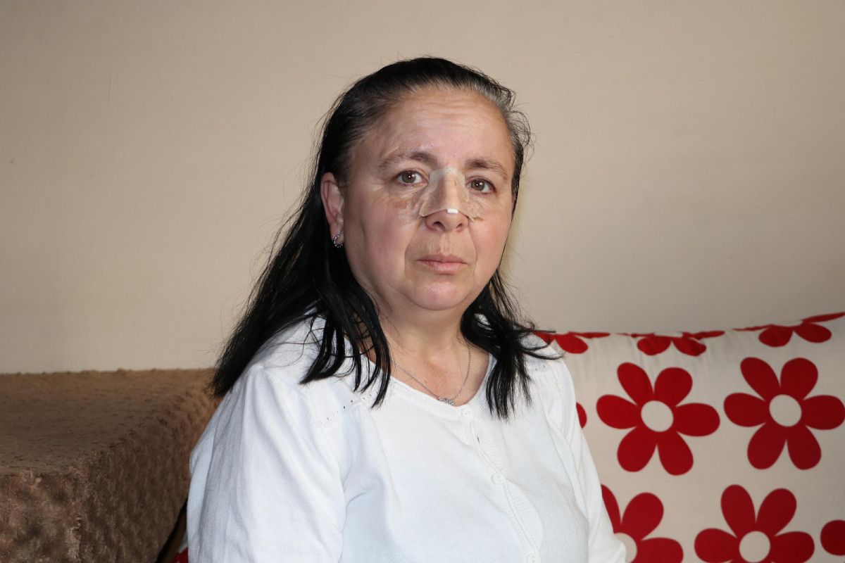 Eskişehir'de birlikte yaşadığı sevgilisi burnunu kırdı