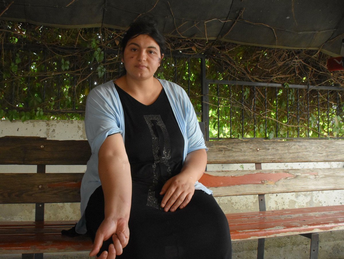 İzmir'de kendisini dövüp bıçaklayan eşi hakkındaki şikayetini geri çekti