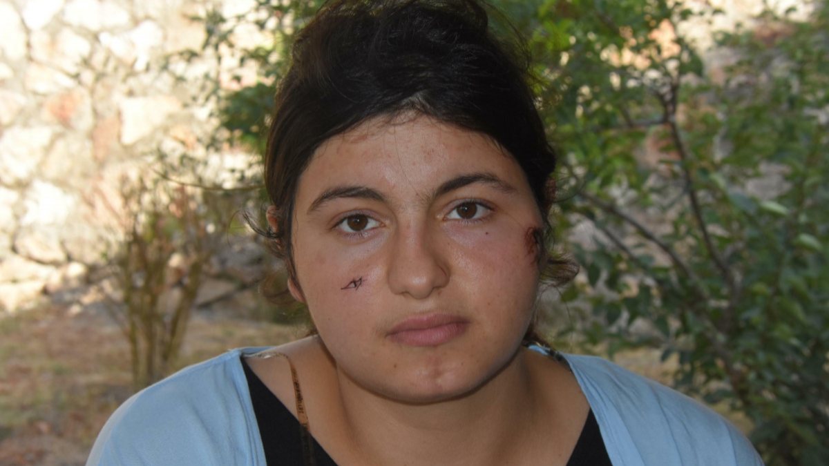 İzmir&#039;de kendisini dövüp bıçaklayan eşi hakkındaki şikayetini geri çekti