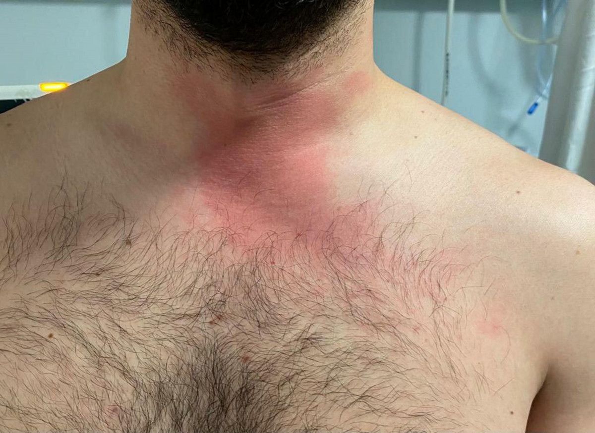 Muğla'da darbedildiğini öne süren doktor hakkında soruşturma