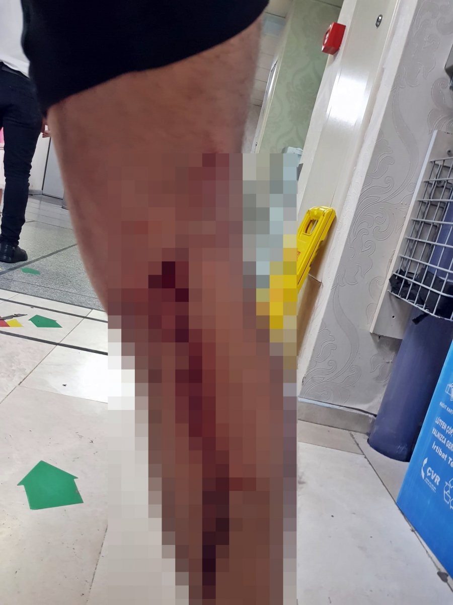 Antalya'da köpek sürüsü, yoldan geçenlere saldırarak yaraladı