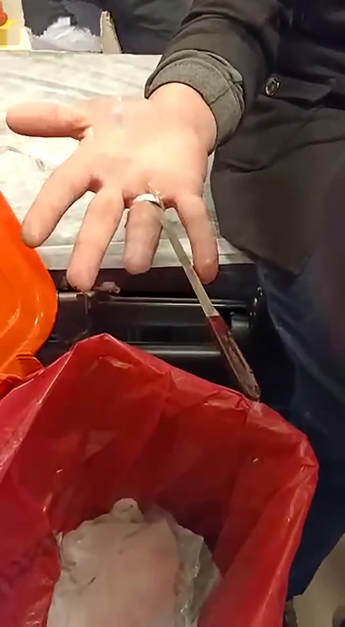 Erzurum'da acil servis, yüzüğü çıkmayan adam için seferber oldu