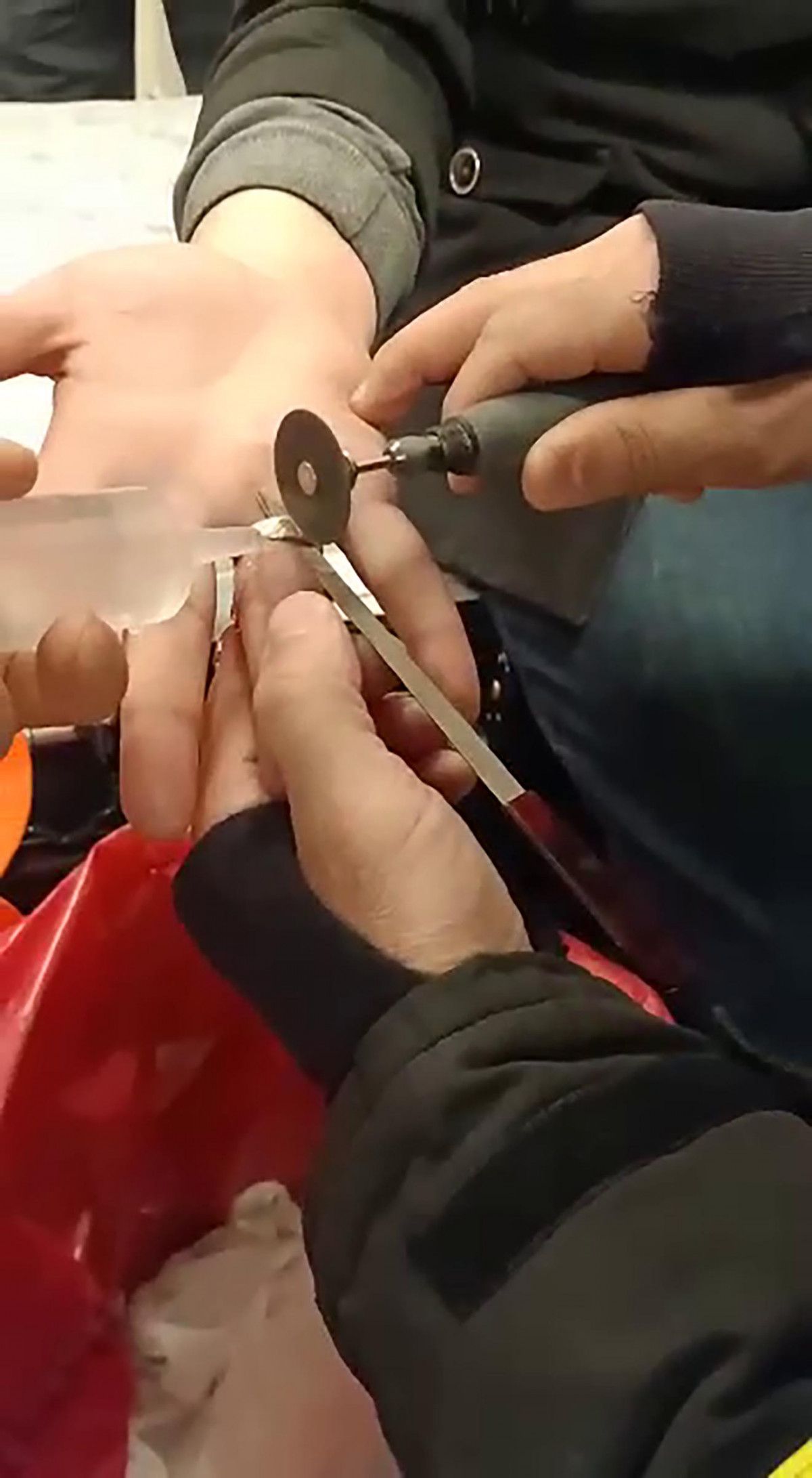 Erzurum'da acil servis, yüzüğü çıkmayan adam için seferber oldu