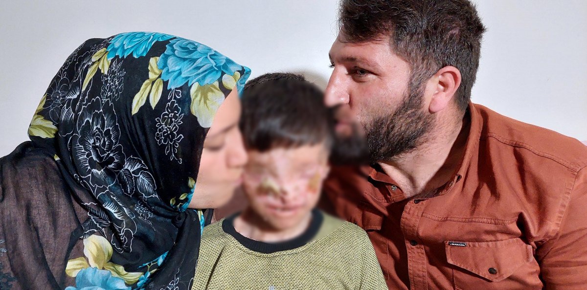 Erzurum'da cilt kanserinden gözleri kapanan Salih: Ailemi görmek istiyorum