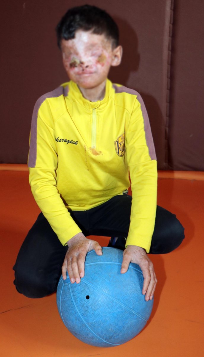 Erzurum'da cilt kanserinden gözleri kapanan Salih: Ailemi görmek istiyorum