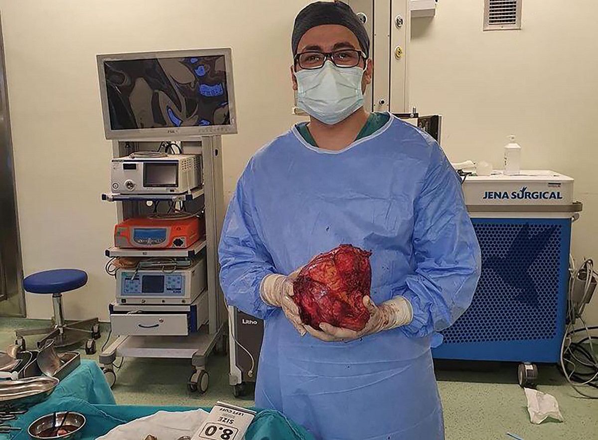 Erzurum'da halsizlik nedeniyle doktora giden adamın karnından kitle çıktı