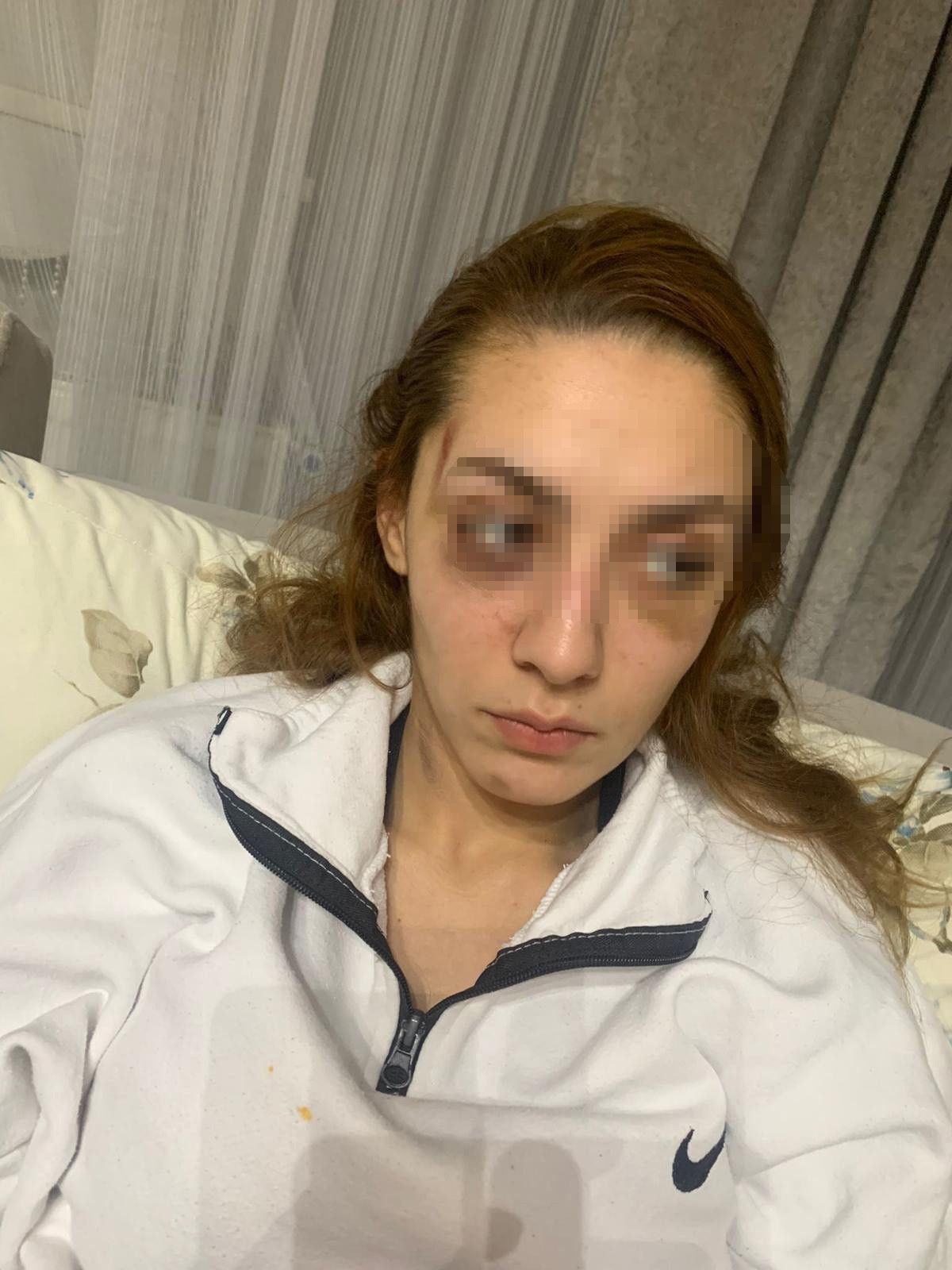 Gaziosmanpaşa'da eşofman yüzünden terk edilen kadın darbedildi