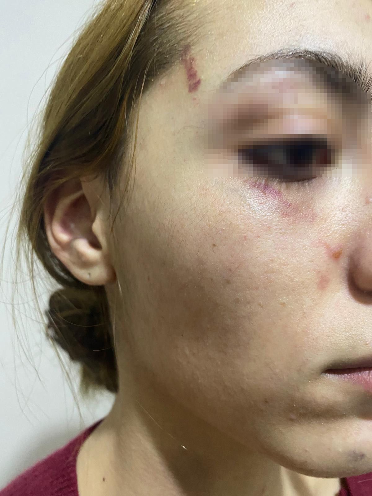 Gaziosmanpaşa'da eşofman yüzünden terk edilen kadın darbedildi