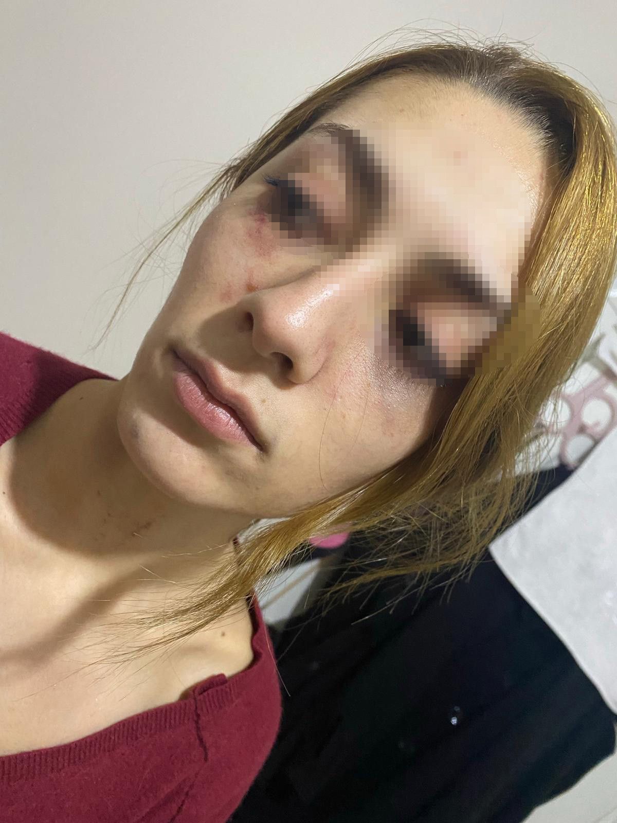 Gaziosmanpaşa'da eşofman yüzünden terk edilen kadın darbedildi