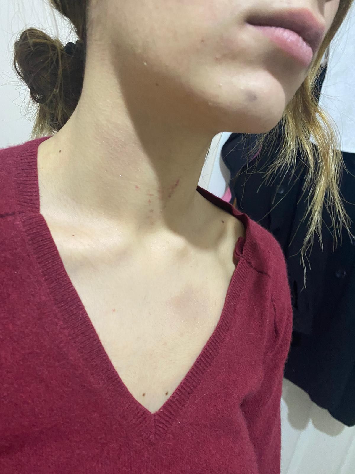 Gaziosmanpaşa'da eşofman yüzünden terk edilen kadın darbedildi