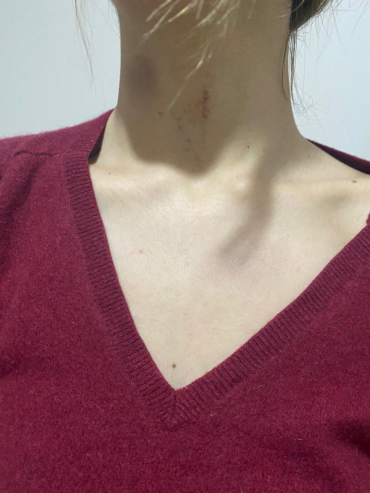 Gaziosmanpaşa'da eşofman yüzünden terk edilen kadın darbedildi