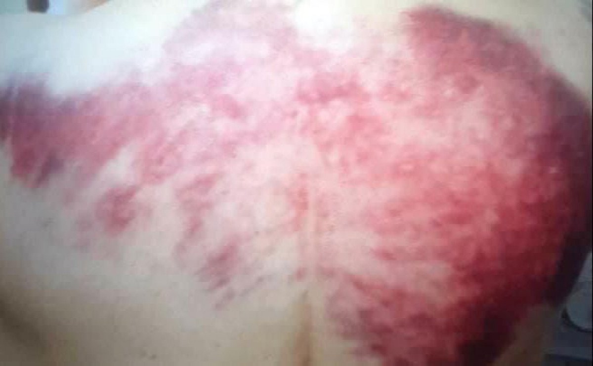 Yengesini bayıltana kadar dövüp, altınlarını çaldı