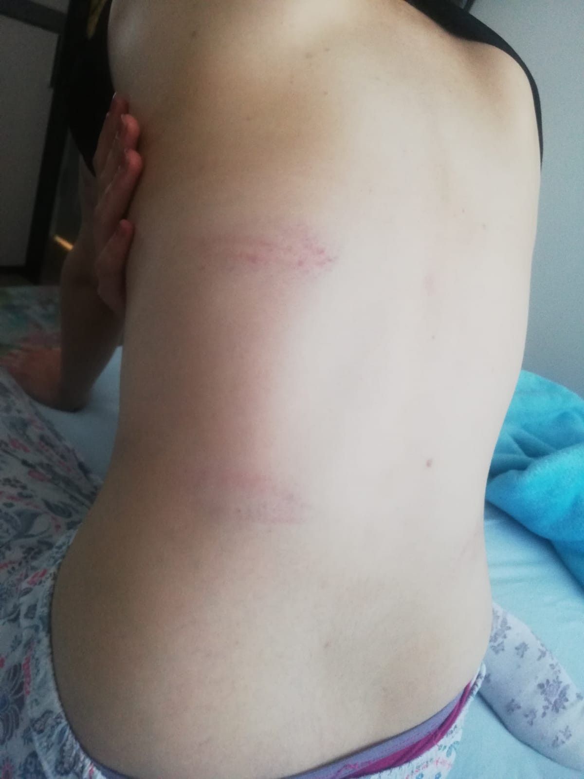 Konya'da kadınların işkence ettiği genç kız konuştu