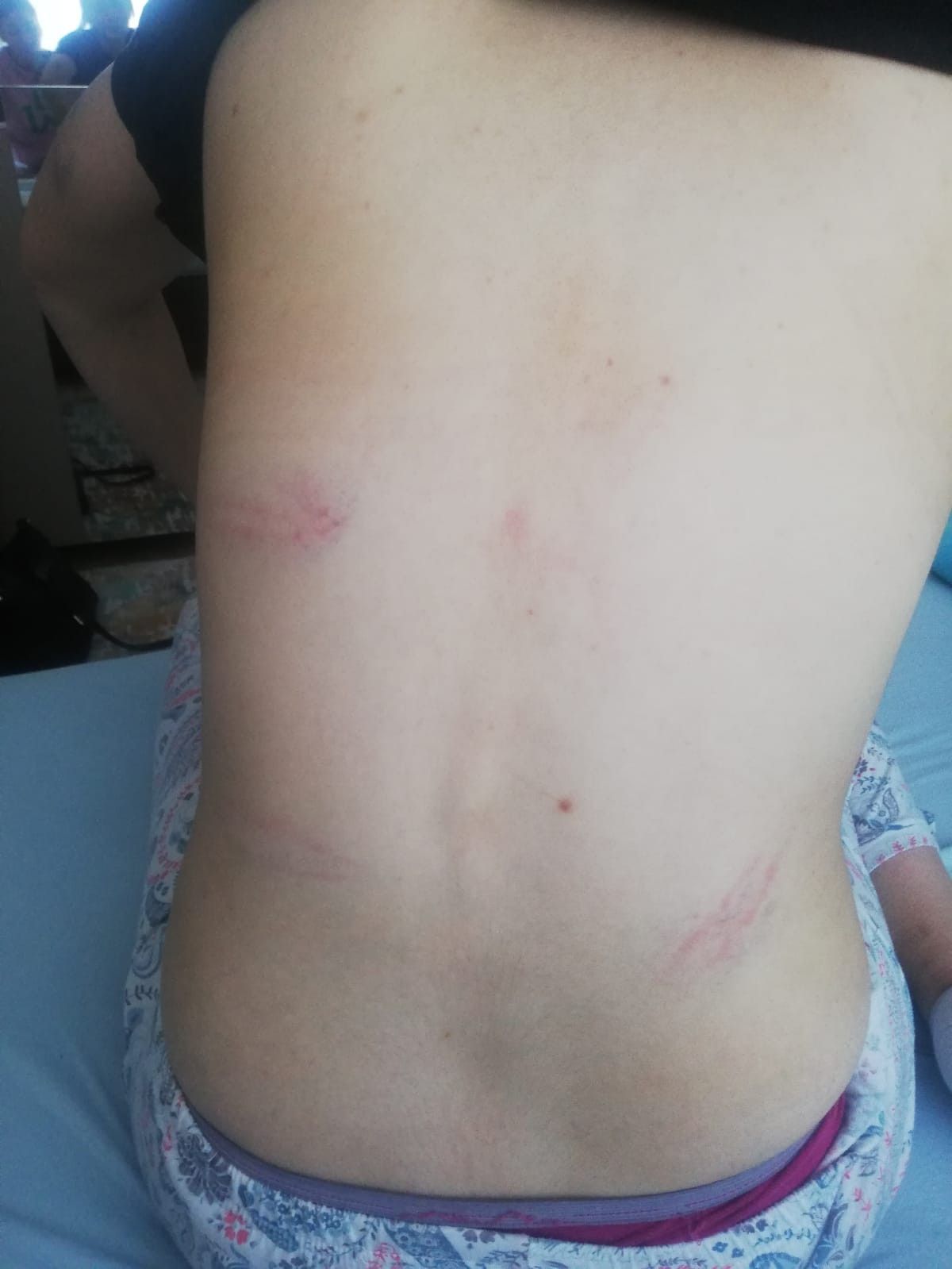 Konya'da kadınların işkence ettiği genç kız konuştu