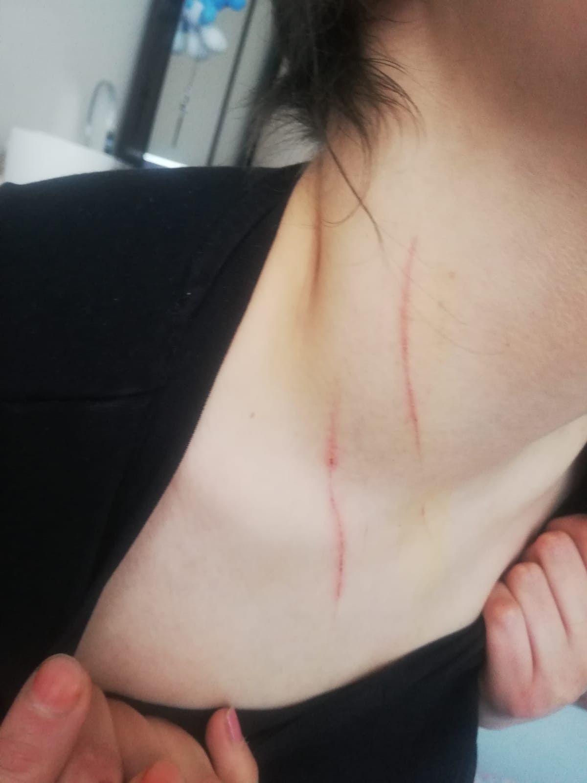 Konya'da kadınların işkence ettiği genç kız konuştu