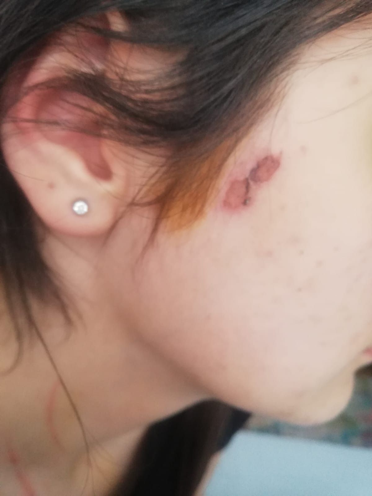 Konya'da kadınların işkence ettiği genç kız konuştu