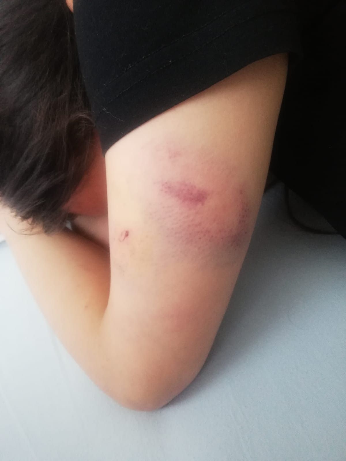 Konya'da kadınların işkence ettiği genç kız konuştu