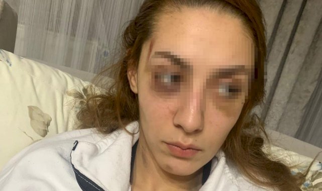 Gaziosmanpaşa'da eşofman yüzünden terk edilen kadın darbedildi