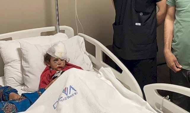 Şanlıurfa'da eşeğin ısırdığı çocuğun göz kapağı koptu