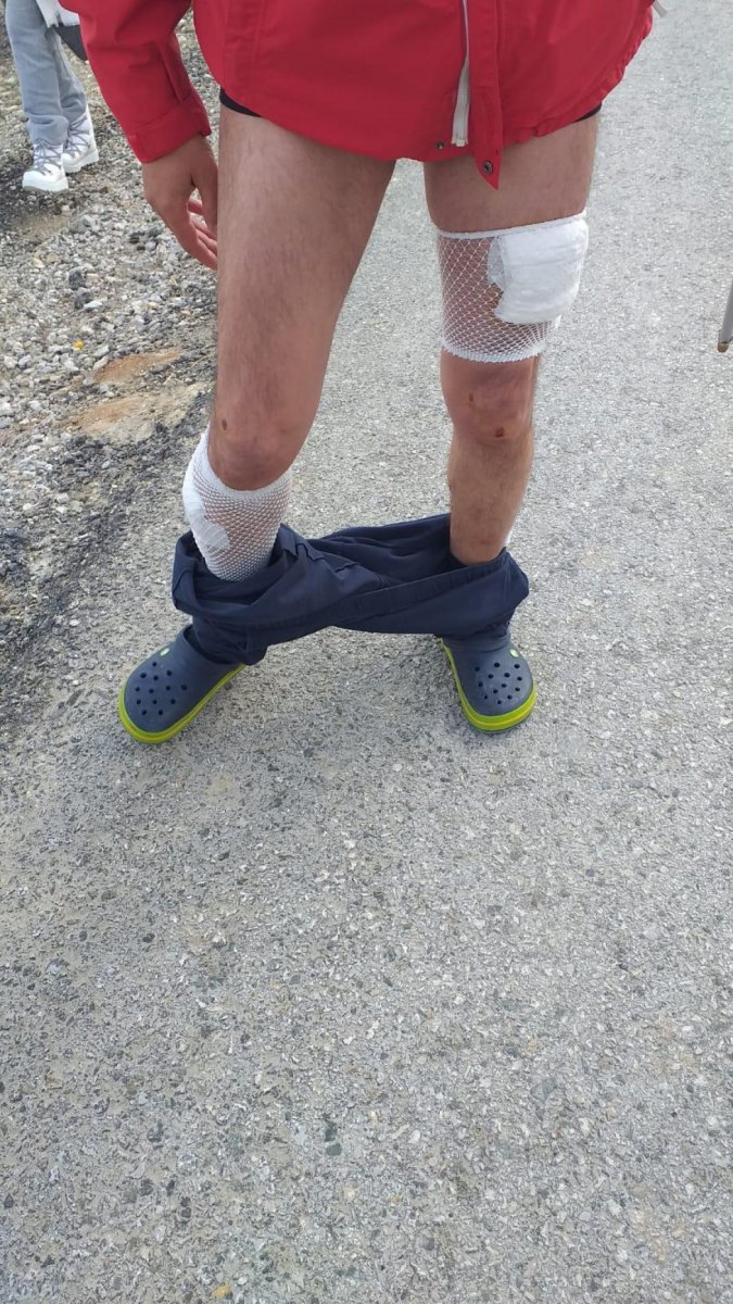 Ankara’daki mahallede 1 ayda 11 köpek saldırısı