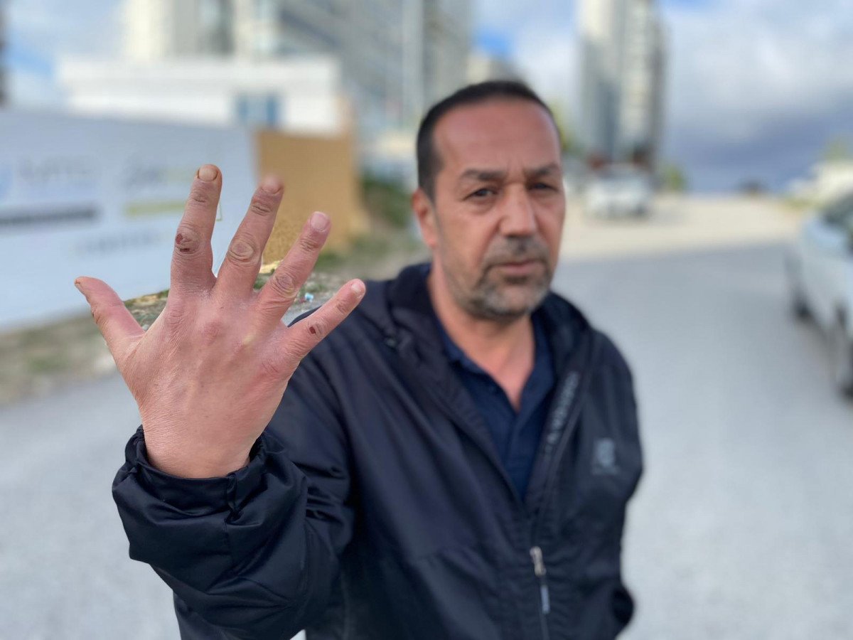 Ankara’daki mahallede 1 ayda 11 köpek saldırısı