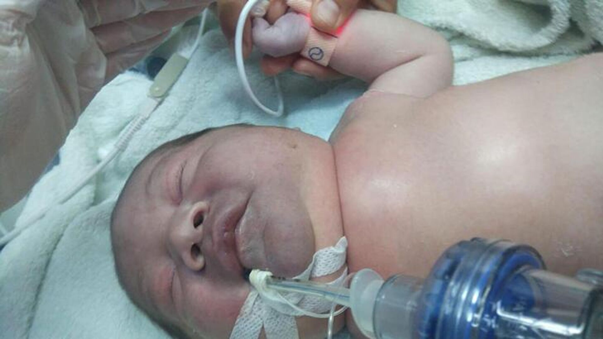 Doğum sırasında bebeğin köprücük kemiğinin kırıldığı iddiası: 'Doğar doğmaz entübe edildi'