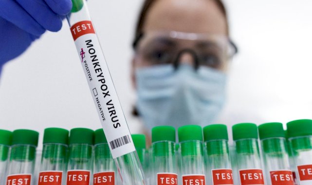 Almanya, maymun çiçeğine karşı aşı sipariş etti