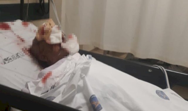 Antalya'da komşusunun köpeği tarafından saldırıya uğradı