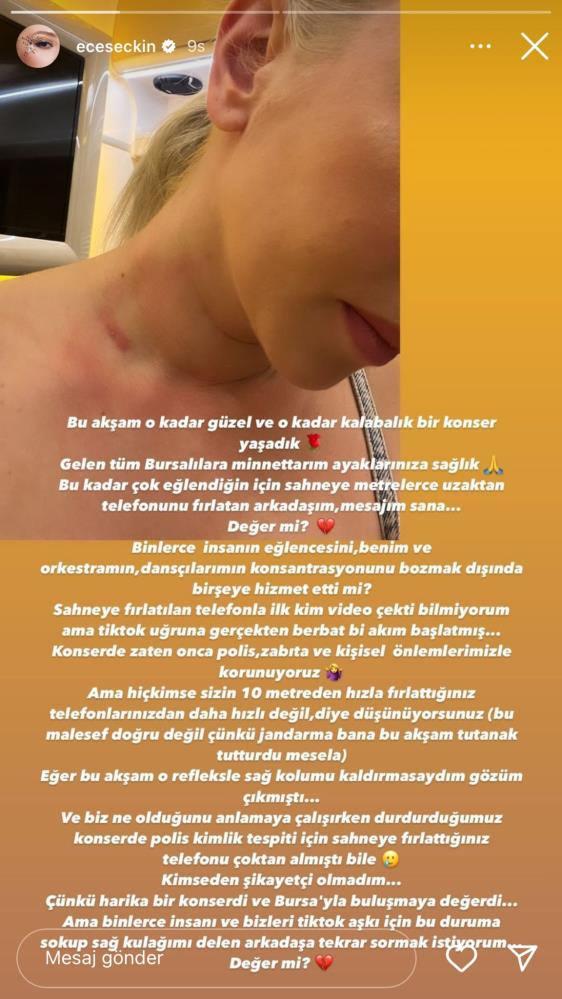 Ece Seçkin'e sahnede büyük şok!