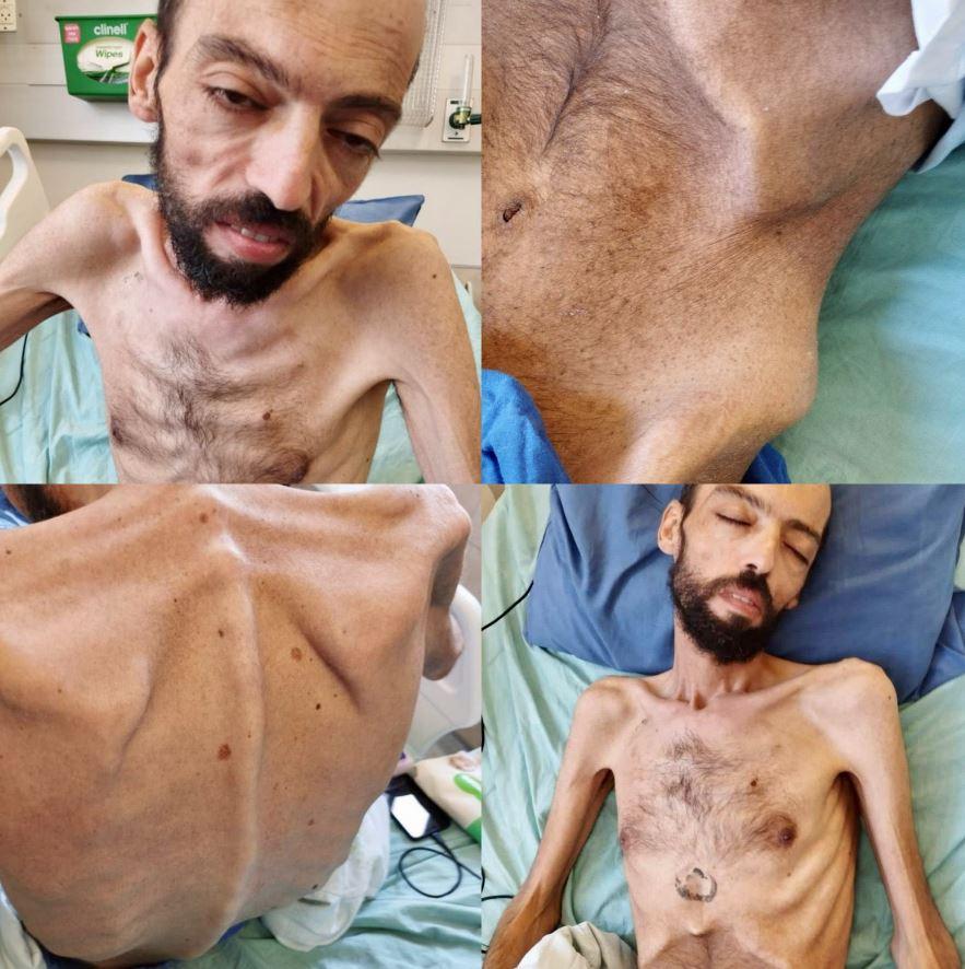 Açlık grevindeki Filistinli ölmek üzere