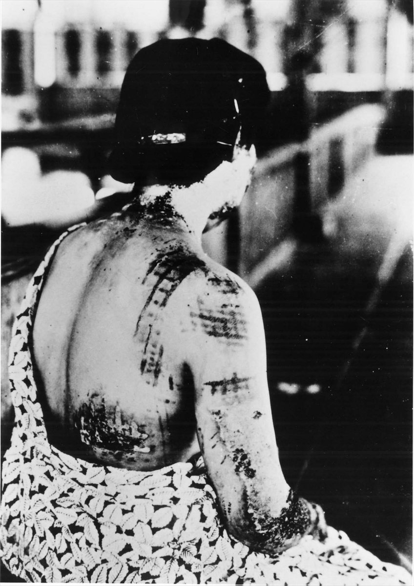 Hiroşima'da atom bombalı saldırısı 77. yılında