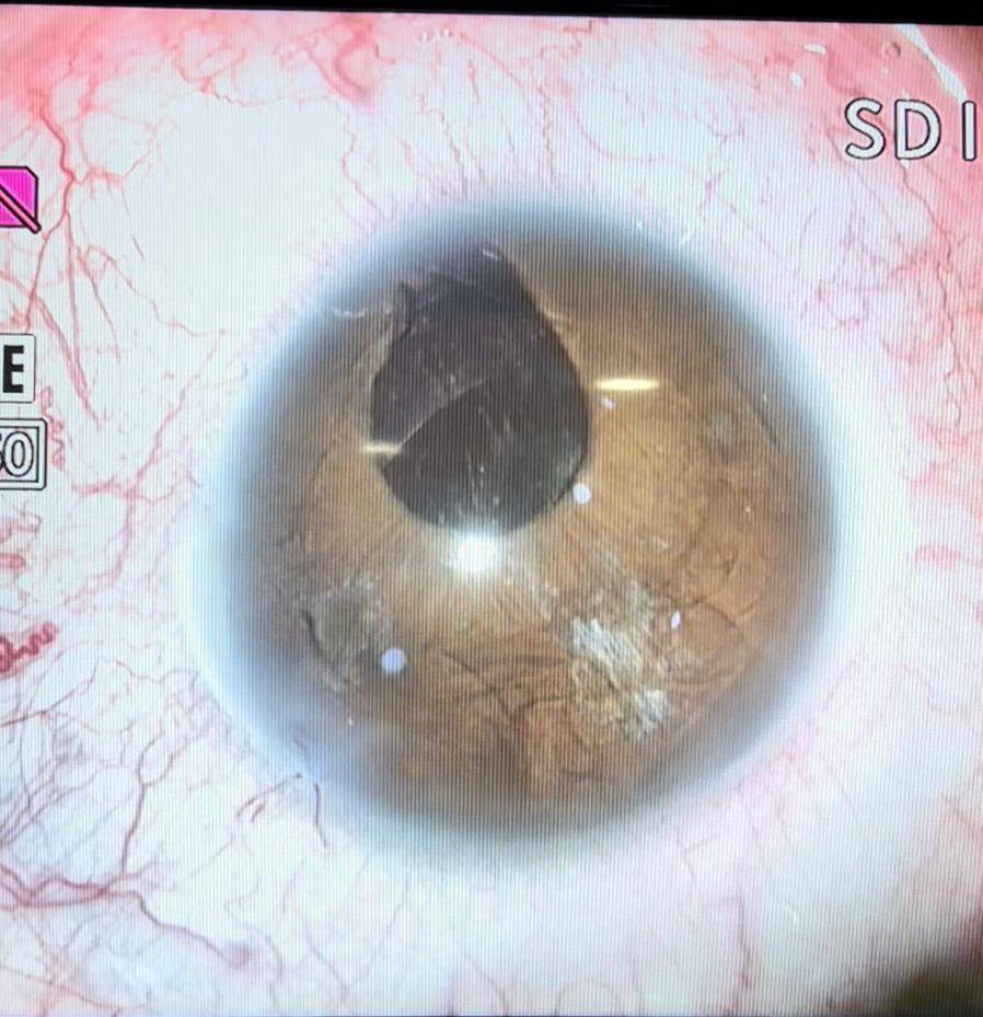 Göz Bebekleri Yere Bakan Gurbetçi İzmir’de Sağlığına Kavuştu