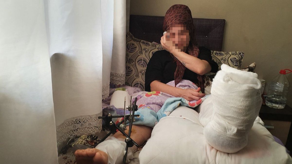 Oğlu tarafından pompalı tüfekle vurulan anne, kangren riski ile karşı karşıya