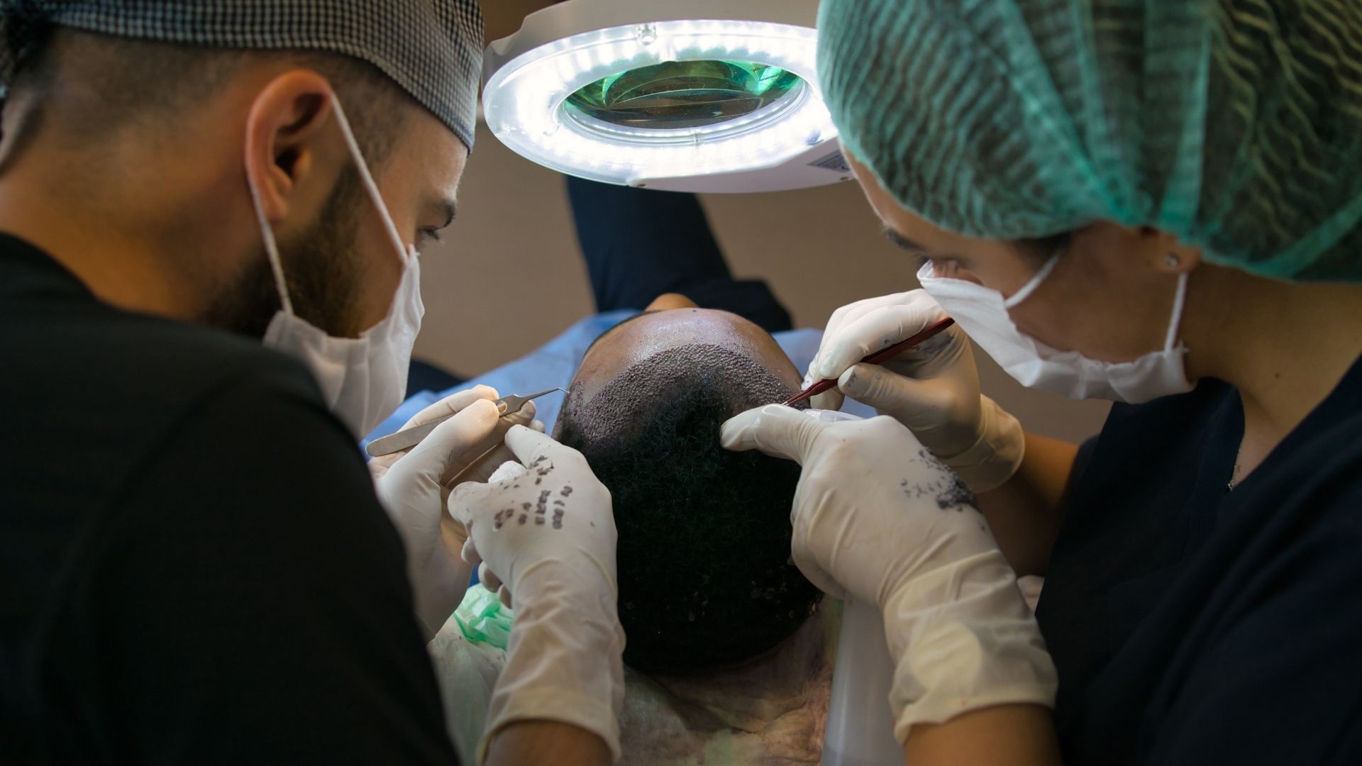 Saç Ekimi Kimlere Yapılır?