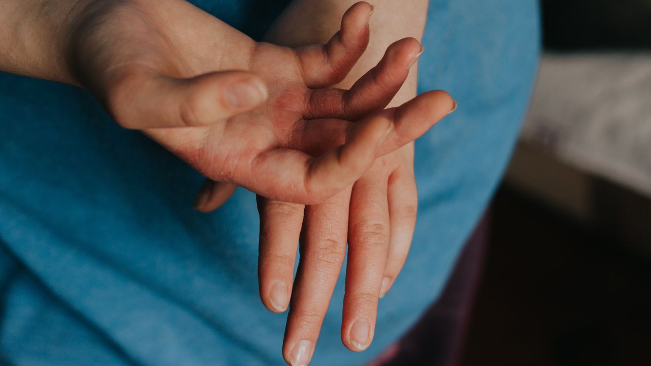 Gece Uyuz Nedeniyle Uyuyamıyor Olabilirsiniz