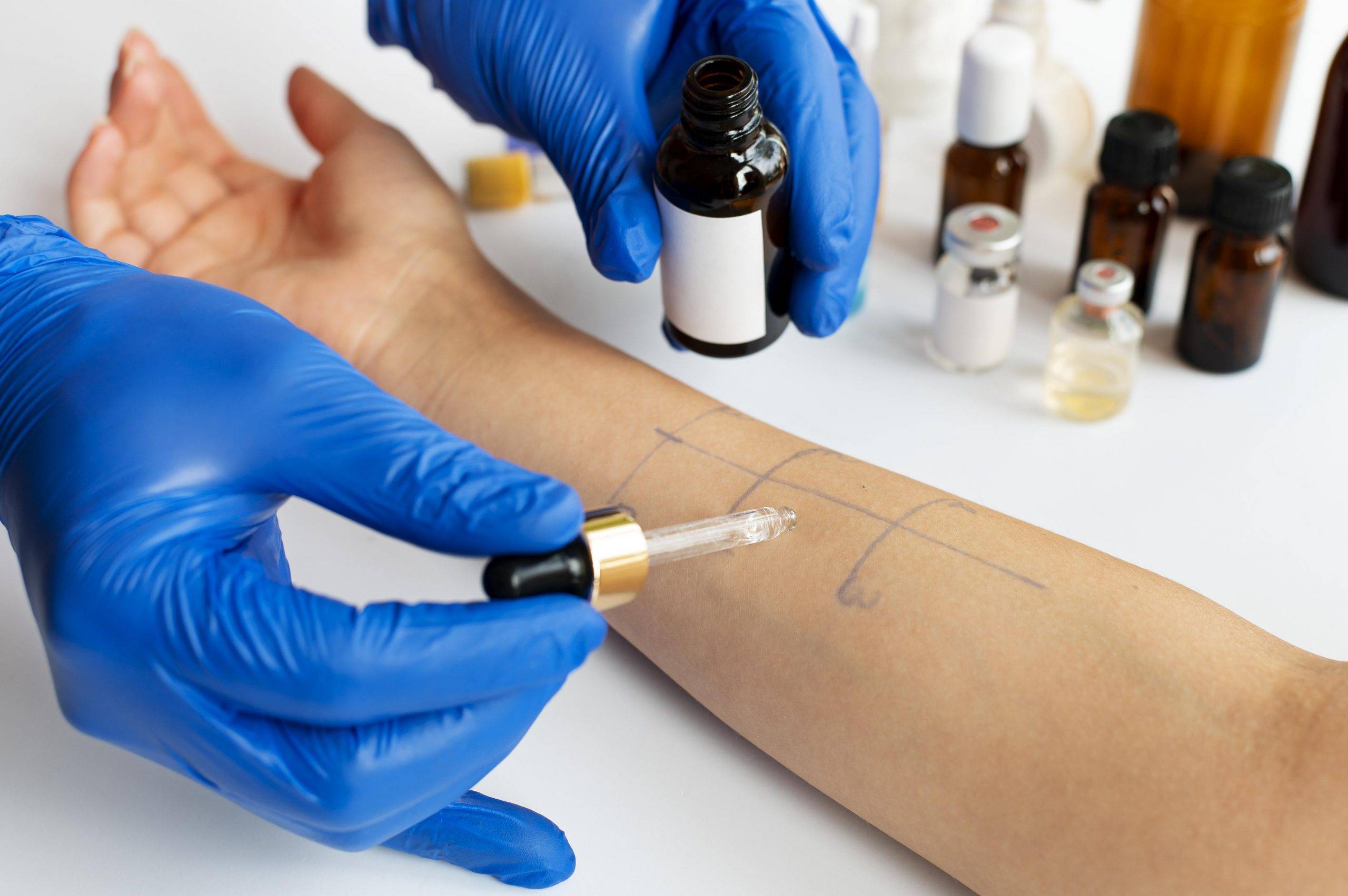 Kene Isırığı, Kırmızı Et Alerjisi Yapıyor