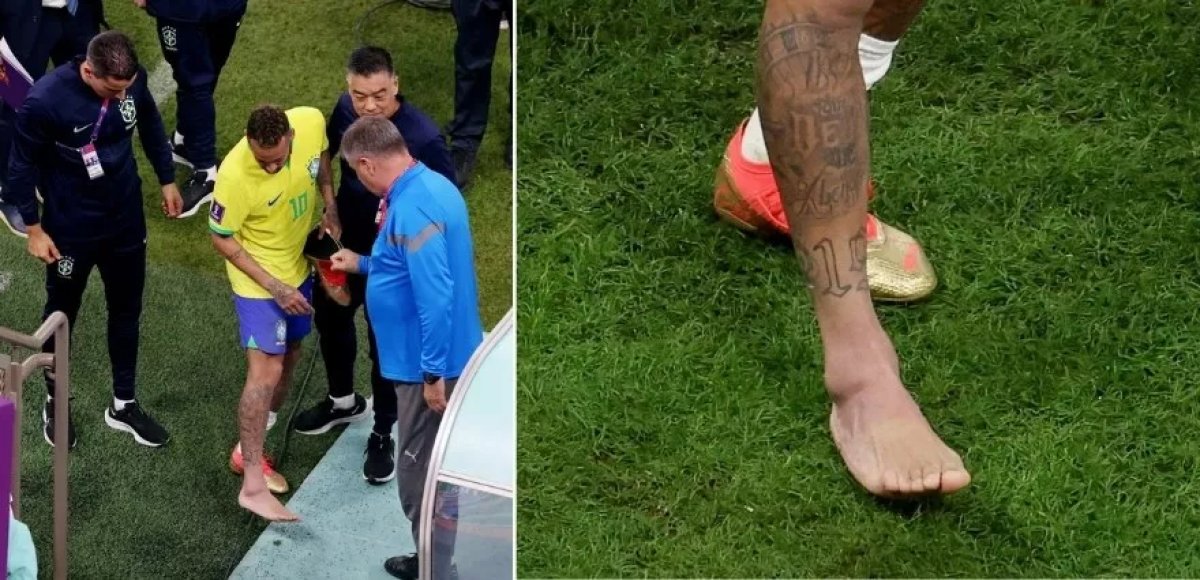 Neymar'ın sağlık durumu