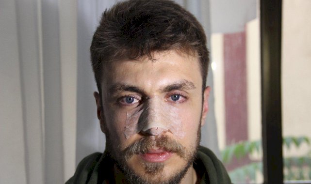 İzmir'de 'Eşimi nasıl muayene edersin' diyerek doktorun burnu kırdı