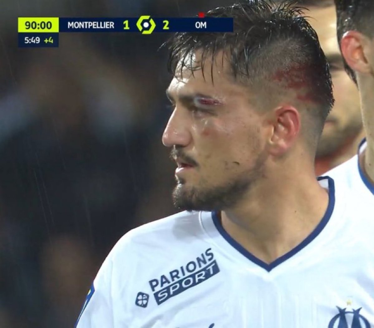 Montpellier maçında kaşı açılan Cengiz Ünder son durumunu paylaştı