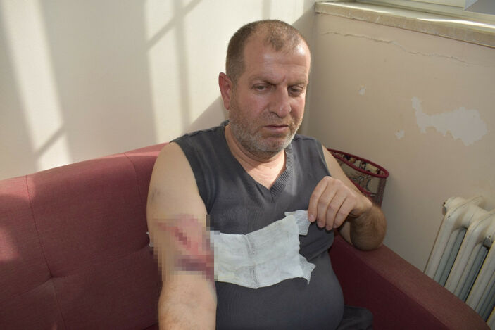 Batman'da okul bahçesinde sahipsiz köpeğin saldırdığı öğretmen ile öğrencisi yaralandı