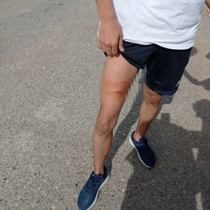 Batman'da okul bahçesinde sahipsiz köpeğin saldırdığı öğretmen ile öğrencisi yaralandı