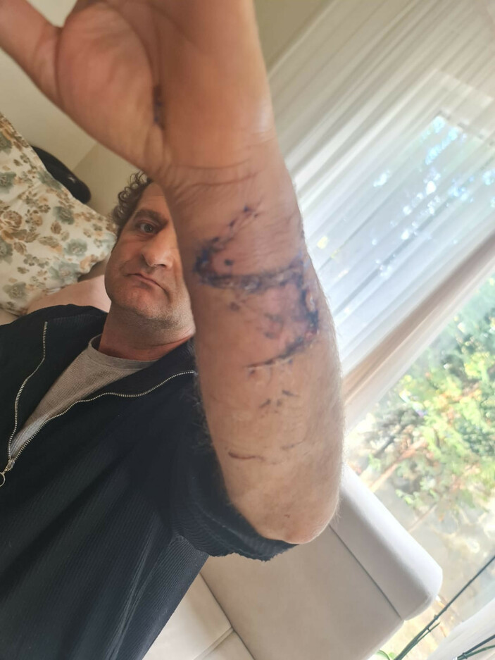 Bursa'da pitbull köpeklerini husumetlilerine saldırtan baba ile oğlu, ağır cezada yargılanacak