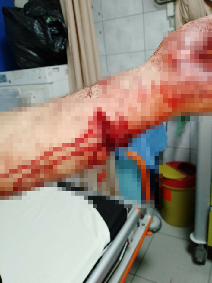 Bursa'da pitbull köpeklerini husumetlilerine saldırtan baba ile oğlu, ağır cezada yargılanacak