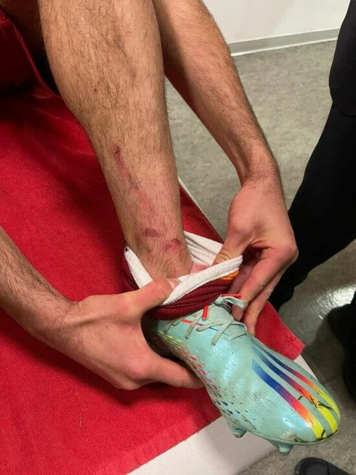 Leo Dubois'dan hakem Zorbay Küçük'e tepki: Ayağımın kırılması mı gerekiyordu