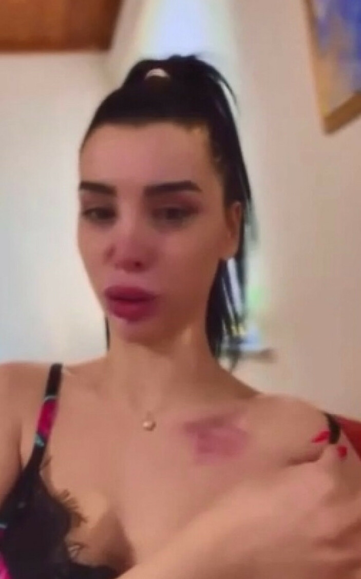 Sosyal medya sallandı! Fenomen Aleyna Eroğlu gözyaşları içinde paylaştı: Eski futbolcudan şiddet gördü