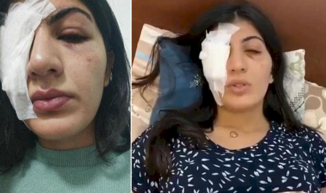 Mersin'de genç kıza içi su dolu balon atan şahıslar tahliye edildi