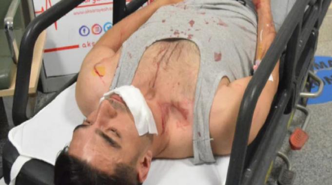 Aksaray'da ayağına basılan adam tepki gösterince bıçaklandı