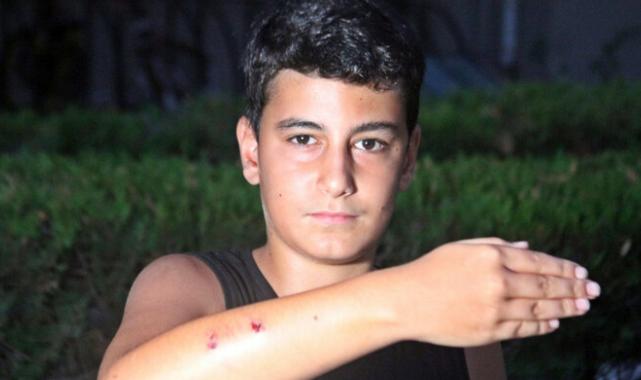 Antalya'da dershaneye giden çocuğa 5 köpek saldırdı: Zıplayıp kolumu ısırdı