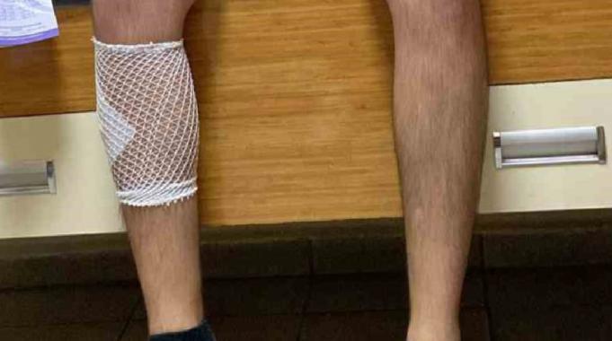 Sonu gelmiyor! Aydın'da sokak köpeklerinin saldırdığı motosikletli yaralandı