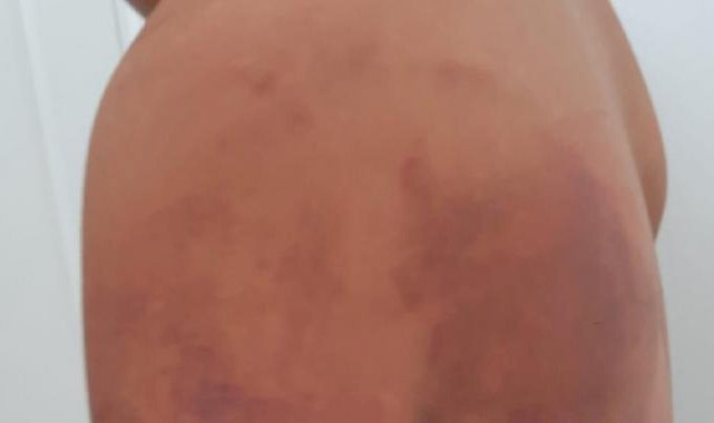 Şanlıurfa'da ailesi tarafından zincirle bağlandı: Üzerime idrarlarını yaptılar